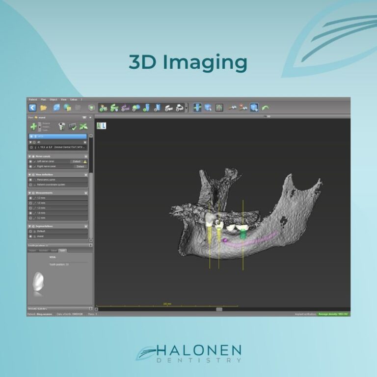 3d dental imaging